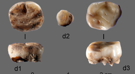 Virus-DNA funnet i 31.600 år gamle tenner