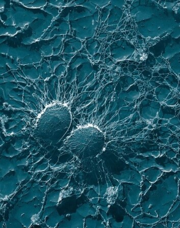 Gule stafylokokker (Staphylococcus aureus). (Foto: Wikimedia Commons) Gule stafylokokker (Staphylococcus aureus). (Foto: Wikimedia Commons)