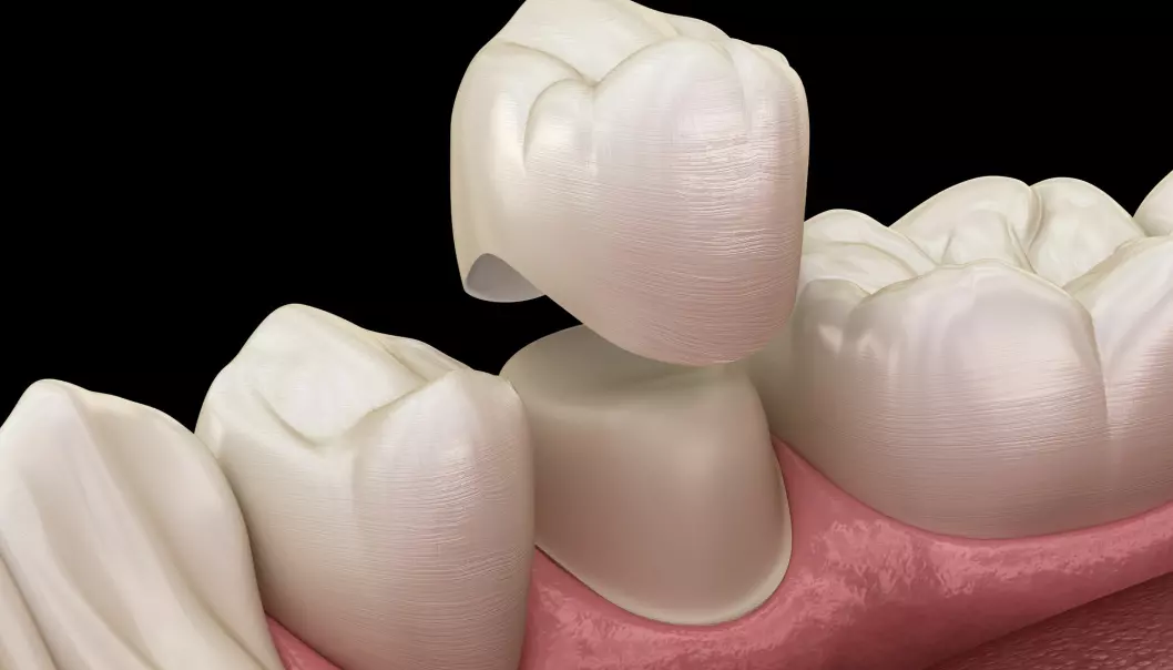 Om en tann er veldig skadet, kan man slipe den ned og sette på en krone.
