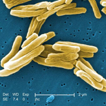 Fargelagte bakterier av Mycobacterium tuberculosis, som forårsaker tuberkulose. (Foto: Janice Haney Carr) Fargelagte bakterier av Mycobacterium tuberculosis, som forårsaker tuberkulose. (Foto: Janice Haney Carr)