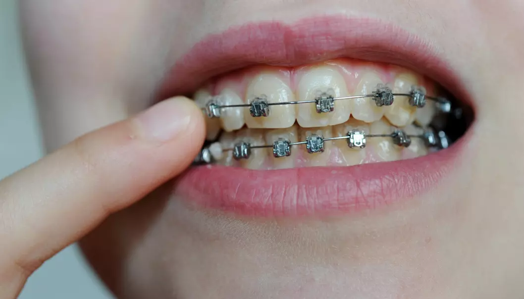 Med tenner som står riktig er det lettere å få rengjort ordentlig, forteller tannlege Kari Sunniva Elde.