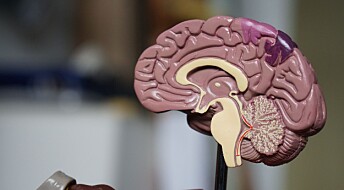 Ny studie tyder på en genetisk sammenheng mellom risikoen for schizofreni og hjernens overflate