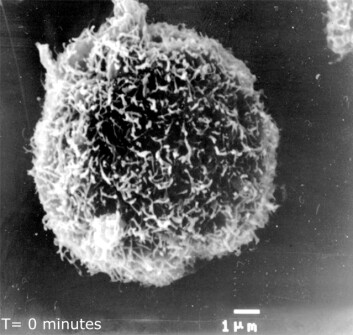 Bildet viser en kreftcelle som er intakt. (Foto: Lytix Biopharma) Bildet viser en kreftcelle som er intakt. (Foto: Lytix Biopharma)