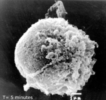 Bildet viser en kreftcelle fem minutter etter at medisinen Oncopore er blitt gitt. Vi ser at cellemembranen begynner å bli ødelagt. (Foto: Lytix Biopharm) Bildet viser en kreftcelle fem minutter etter at medisinen Oncopore er blitt gitt. Vi ser at cellemembranen begynner å bli ødelagt. (Foto: Lytix Biopharm)