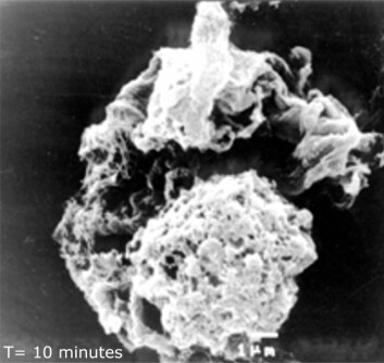 Bildet viser en kreftcelle 10 minutter etter at medisinen Oncopore er blitt gitt. Vi ser at cellemembranen har gått i oppløsning. (Foto: Lytix Biopharm) Bildet viser en kreftcelle 10 minutter etter at medisinen Oncopore er blitt gitt. Vi ser at cellemembranen har gått i oppløsning. (Foto: Lytix Biopharm)