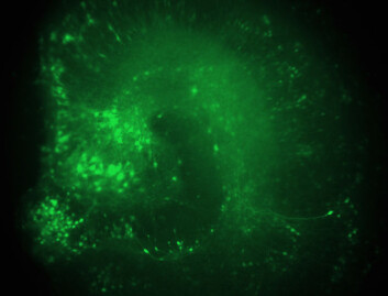 Bildet viser tverrsnittet av hippocampus i en rottehjerne. Nervecellene, som lyser grønt, har fått skrudd ned aktiviteten til KCNQ3-genet og sender dermed impulser ukontrollert, slik som ved epilepsi. (Foto: UiO) Bildet viser tverrsnittet av hippocampus i en rottehjerne. Nervecellene, som lyser grønt, har fått skrudd ned aktiviteten til KCNQ3-genet og sender dermed impulser ukontrollert, slik som ved epilepsi. (Foto: UiO)