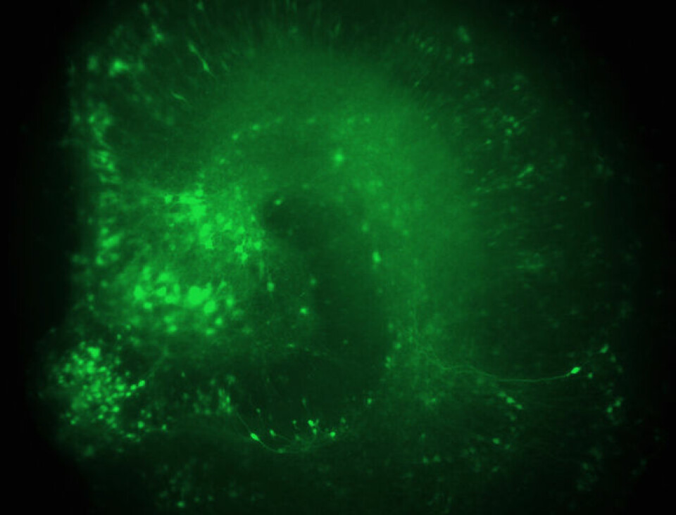 Bildet viser tverrsnittet av hippocampus i en rottehjerne. Nervecellene, som lyser grønt, har fått skrudd ned aktiviteten til KCNQ3-genet og sender dermed impulser ukontrollert, slik som ved epilepsi. (Foto: UiO)