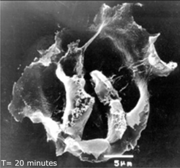 Bildet viser en kreftcelle 20 minutter etter at medisinen Oncopore er blitt gitt. Vi ser at cellen er sprengt. (Foto: Lytix Biopharm) Bildet viser en kreftcelle 20 minutter etter at medisinen Oncopore er blitt gitt. Vi ser at cellen er sprengt. (Foto: Lytix Biopharm)