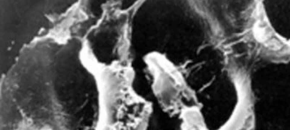 Bildet viser en kreftcelle 20 minutter etter at medisinen Oncopore er blitt gitt. Vi ser at cellen er sprengt. (Foto: Lytix Biopharm)