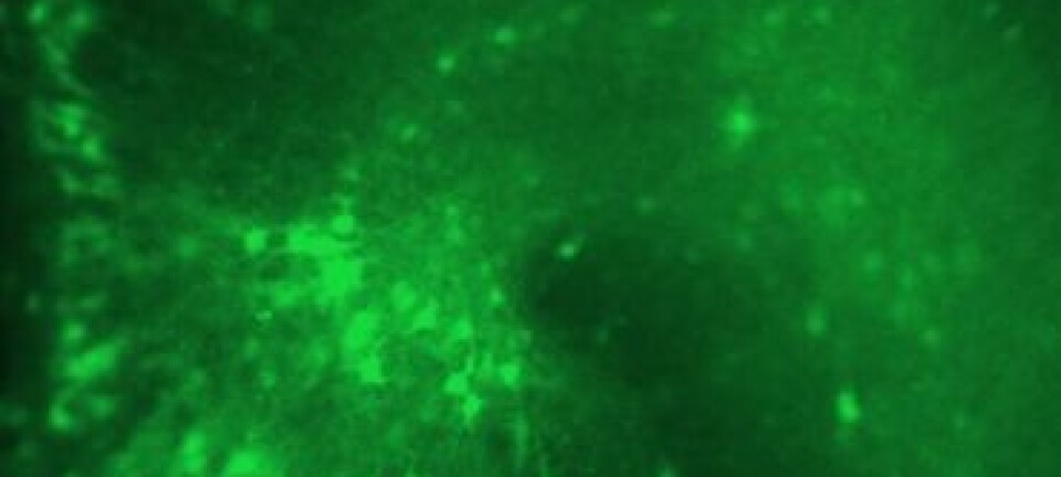 Bildet viser tverrsnittet av hippocampus i en rottehjerne. Nervecellene, som lyser grønt, har fått skrudd ned aktiviteten til KCNQ3-genet og sender dermed impulser ukontrollert, slik som ved epilepsi. (Foto: UiO)