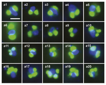 Rappemonader (Foto: Kim, Harrison, Sudek et al. PNAS 2010) Rappemonader (Foto: Kim, Harrison, Sudek et al. PNAS 2010)
