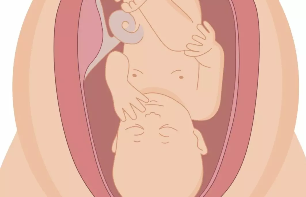 Moren og babyen henger sammen i morkaka og navlestrengen. Blodet til mor og baby er i nær kontakt i morkaka, og her henter babyen oksygen.