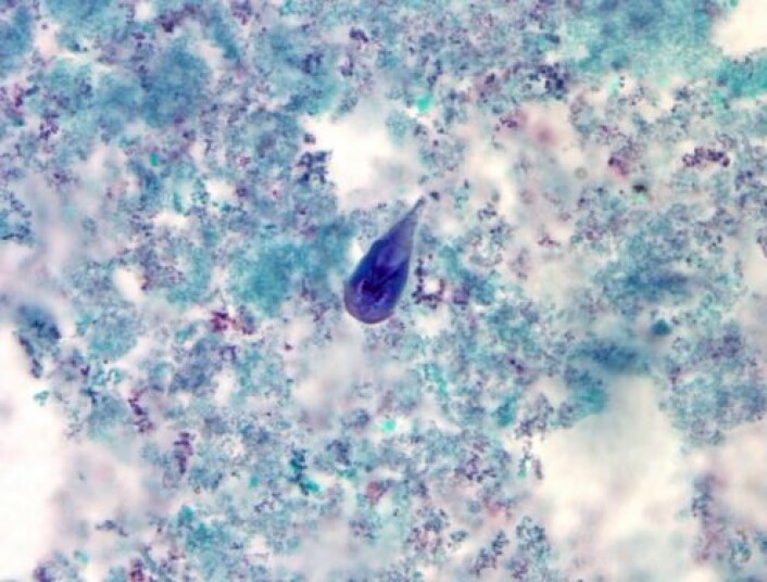 Giardia-parasitten (mørkeblå organisme midt på bildet) er en vanlig årsak til diaré i mange fattige land. (Foto: Centers for Disease Control and Prevention (CDC)/DPDx - Melaine Moser/Public Health Image Library)