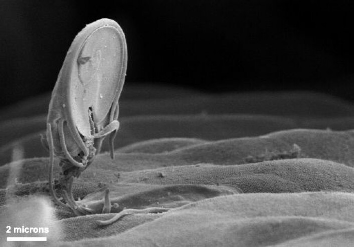 Giardia-parasitt (trofozoitt) i oppreist posisjon. Sugekoppen den bruker til å feste seg til det indre av tarmen er synlig. Størrelsen antydes av linjalen. '2 microns' er 2 mikrometer (1000 mikrometer = 1 millimeter). (Foto: Centers for Disease Control and Prevention (CDC)/Dr. Stan Erlandsen/Public Health Image Library)
