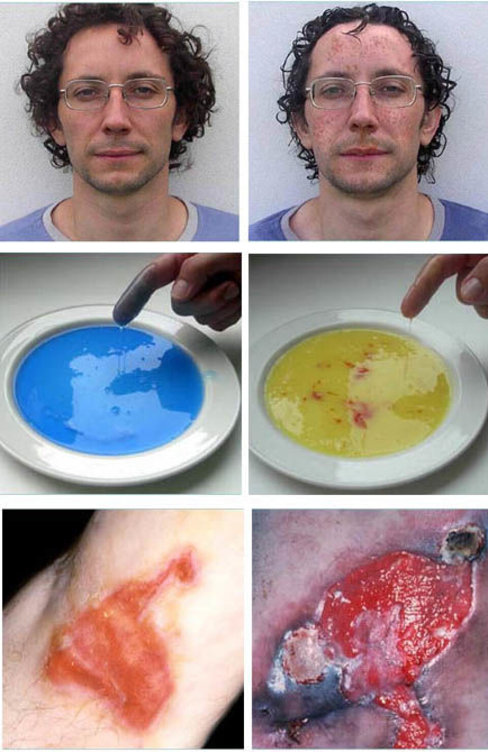 'Folk flest syntes at bildene på høyresida var eklest. (Foto: Val Curtis, London School of Hygiene & Tropical Medicine)'