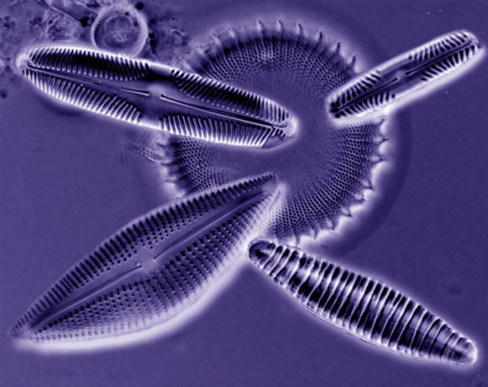 Mikroskopbildet viser alger av de lignende arter som ble brukt i forsøkene med biomangfold på University of Michigan. (Foto: Danuta Bennett) Mikroskopbildet viser alger av de lignende arter som ble brukt i forsøkene med biomangfold på University of Michigan. (Foto: Danuta Bennett)