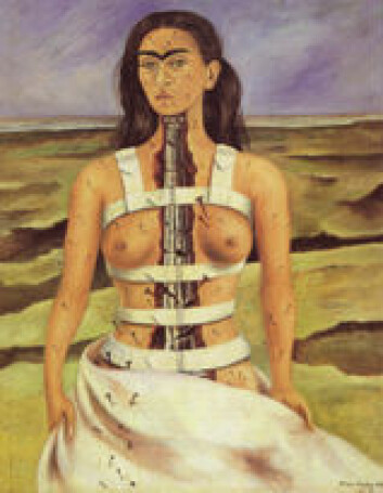 "Frida Kahlo: Brukken ryggrad." "Frida Kahlo: Brukken ryggrad."