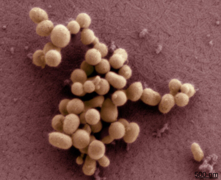 Dette er Craig Venters såkalte syntetiske bakterie, som forskerne har døpt M. mycoides JCVI-syn1.0. (Foto: Tom Deerinck og Mark Ellisman) Dette er Craig Venters såkalte syntetiske bakterie, som forskerne har døpt M. mycoides JCVI-syn1.0. (Foto: Tom Deerinck og Mark Ellisman)