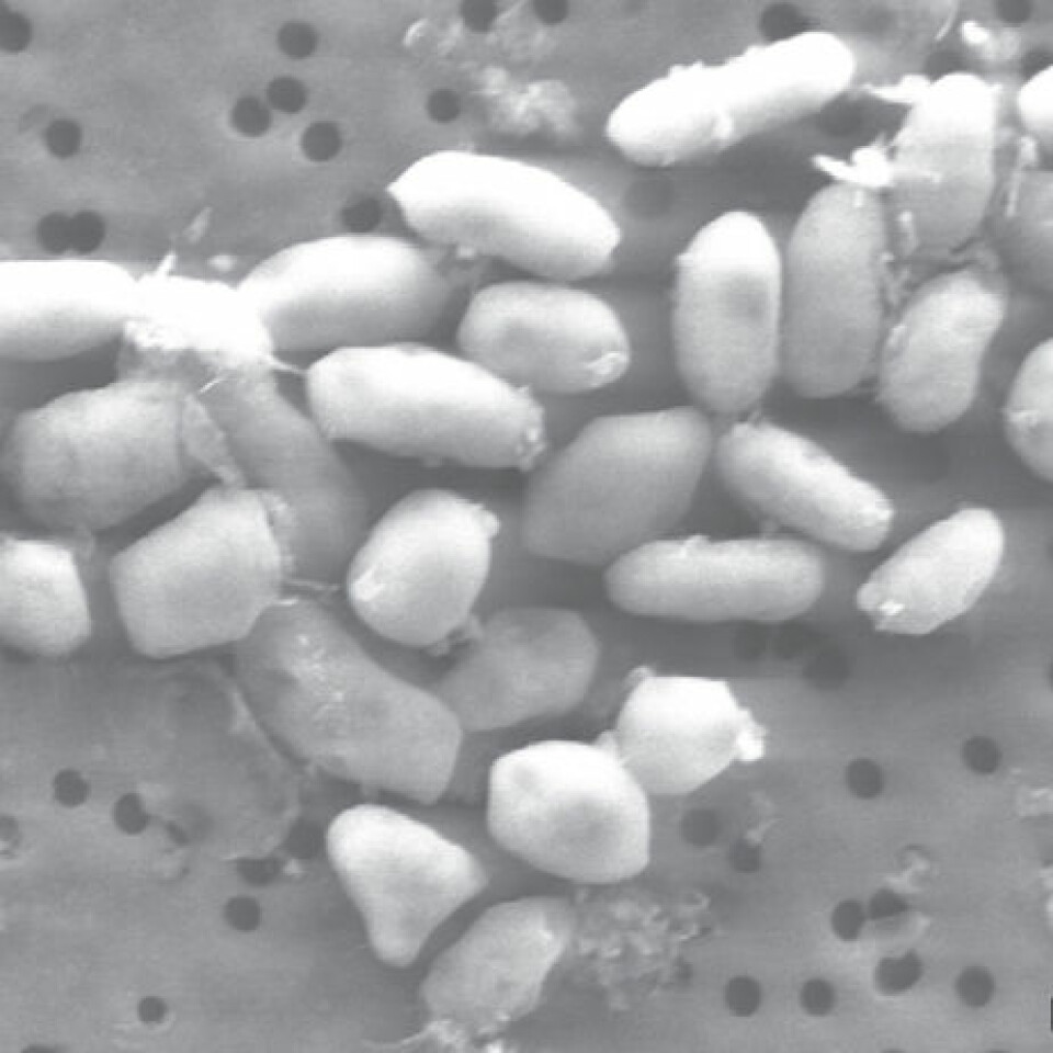 'Arsen-bakterien' GFAJ-1 fra Mono Lake i California (Foto: © 2009 Henry Bortman)