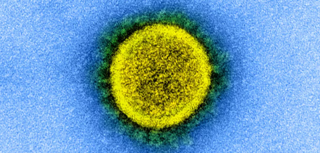 Var du koronasyk i januar og begynnelsen av februar? Da var det sannsynligvis med omikron-varianten BA.1. Blir du smittet nå så er det nesten sikkert med omikron BA.2. Dette er en enda mer smittsom og kanskje litt snillere variant. Her er det bittelille koronaviruset sett gjennom et elektronmikroskop.