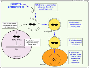 Enkel figur av en akutt promyelocytisk leukemicelle. Det kreftfremkallende fusjonsproteinet PML-RARA er fortrinnsvis lokalisert i cellekjernen, hvor det aktivt hemmer uttrykket av gener som er viktige for cellens normale utvikling mot å bli granulocytt (en type hvit blodcelle). Noe av PML-RARA kommer seg imidlertid på ukjent vis ut av cellekjernen og blir gjenkjent av cellens maskineri for selvspising (autofagi). Dette er trolig en mekanisme som motvirker cellens utvikling mot å bli en kreftcelle. Retinsyre og arsentrioksid stimulerer denne mekanismen ytterligere, og dette kan være en av hovedforklaringene på hvordan disse medikamentene kurerer pasienter med akutt promyelocytisk leukemi. Figur: Nikolai Engedal. Enkel figur av en akutt promyelocytisk leukemicelle. Det kreftfremkallende fusjonsproteinet PML-RARA er fortrinnsvis lokalisert i cellekjernen, hvor det aktivt hemmer uttrykket av gener som er viktige for cellens normale utvikling mot å bli granulocytt (en type hvit blodcelle). Noe av PML-RARA kommer seg imidlertid på ukjent vis ut av cellekjernen og blir gjenkjent av cellens maskineri for selvspising (autofagi). Dette er trolig en mekanisme som motvirker cellens utvikling mot å bli en kreftcelle. Retinsyre og arsentrioksid stimulerer denne mekanismen ytterligere, og dette kan være en av hovedforklaringene på hvordan disse medikamentene kurerer pasienter med akutt promyelocytisk leukemi. Figur: Nikolai Engedal.