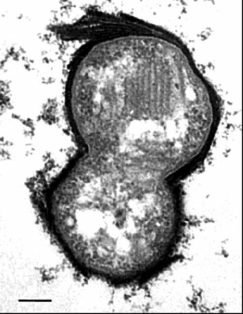 "Methylococcus capsulatus kan brukes til å lage spiselige vaksiner, såkalte oralvaksiner*>Ufarlig bakterie Bakterien Methylococcus capsulatus (M. capsulatus) skiller seg fra mange andre bakterier ved at den har lite av de stoffene som kan være giftige for blant annet mennesker. Det gjør den til en velegnet vaksinekandidat. "Methylococcus capsulatus kan brukes til å lage spiselige vaksiner, såkalte oralvaksiner*>Ufarlig bakterie Bakterien Methylococcus capsulatus (M. capsulatus) skiller seg fra mange andre bakterier ved at den har lite av de stoffene som kan være giftige for blant annet mennesker. Det gjør den til en velegnet vaksinekandidat.