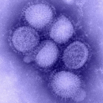 Influensa A (H1N1-virus). Tidligere kjent som svineinfluensa. Fargelagt med blått. (Foto: CDC) Influensa A (H1N1-virus). Tidligere kjent som svineinfluensa. Fargelagt med blått. (Foto: CDC)