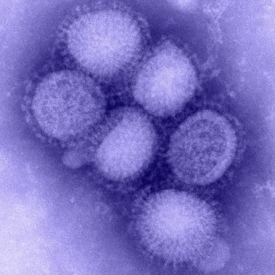 Influensa A (H1N1-virus). Tidligere kjent som svineinfluensa. Fargelagt med blått. (Foto: CDC)