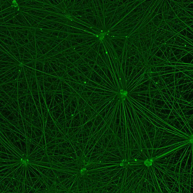 Bildet av et nettverk av nerveceller tok andreplassen.