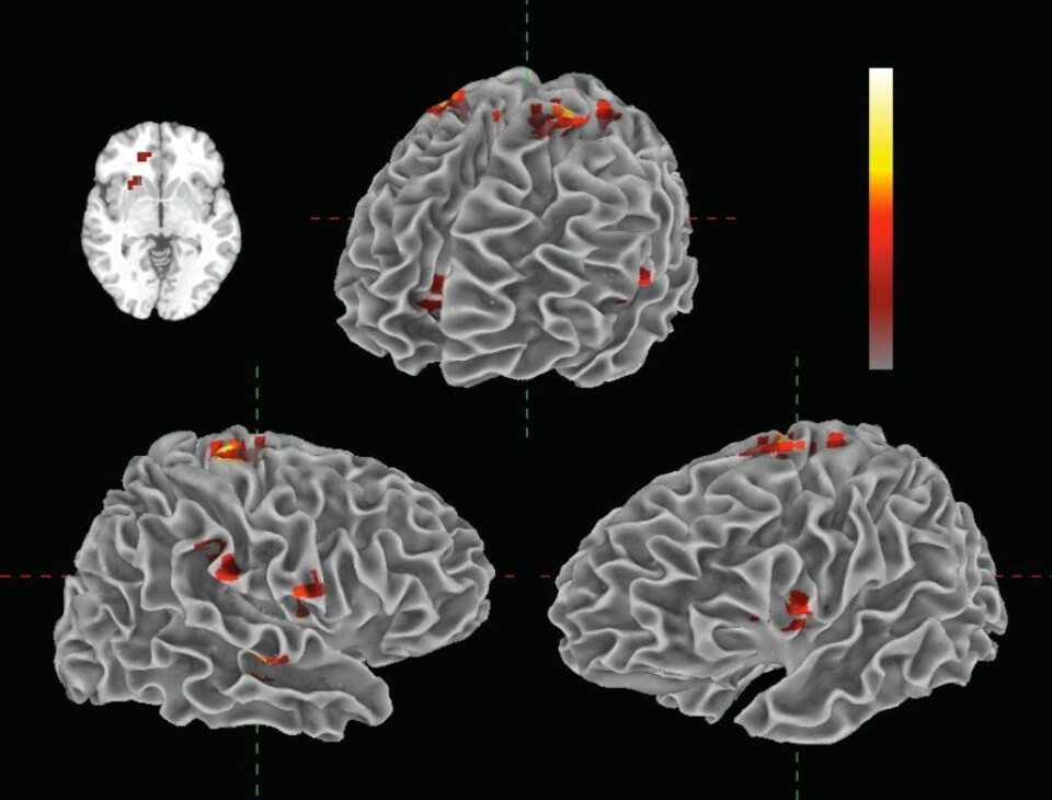 'Illustrasjonen viser de ulike områdene i hjernen som aktiveres ved musikklytting. (Illustrasjon: Florida Atlantic University)'