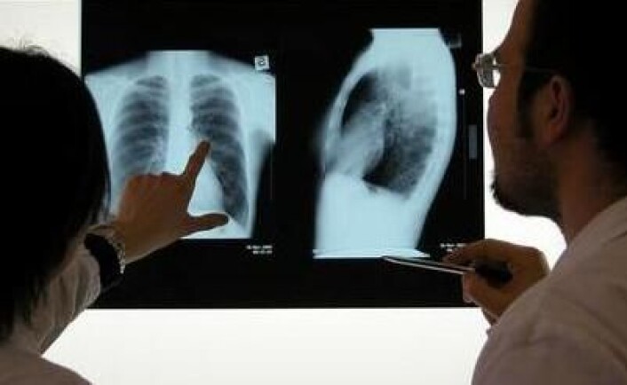 Hvert år dør ca 2000 nordmenn av lungekreft. Det er den vanligste kreftformen i verden. Foto: Shutterstock Hvert år dør ca 2000 nordmenn av lungekreft. Det er den vanligste kreftformen i verden. Foto: Shutterstock