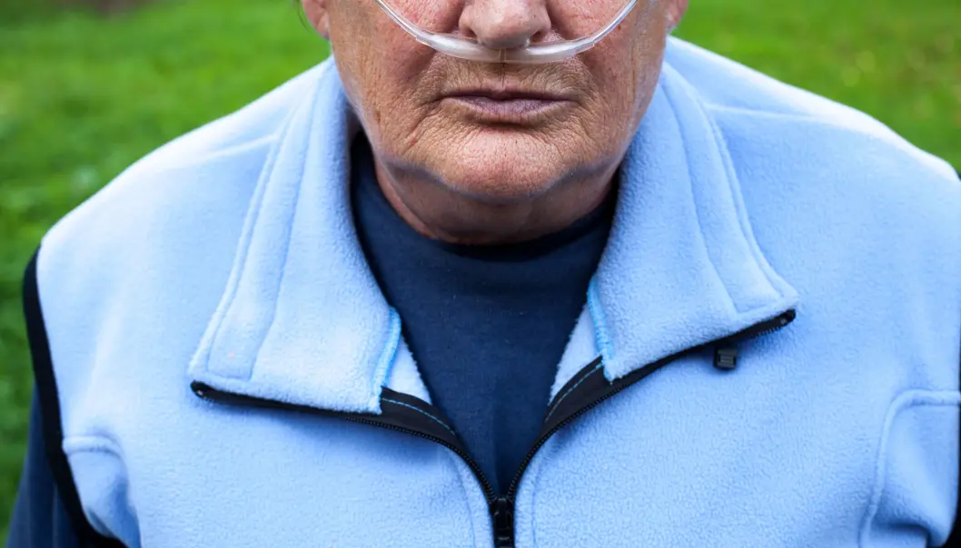Blant folk over 40 år rammes seks prosent av den norske befolkningen av den kroniske lungesykdommen KOLS. Blant folk over 40 år rammes seks prosent av den norske befolkningen av den kroniske lungesykdommen KOLS.