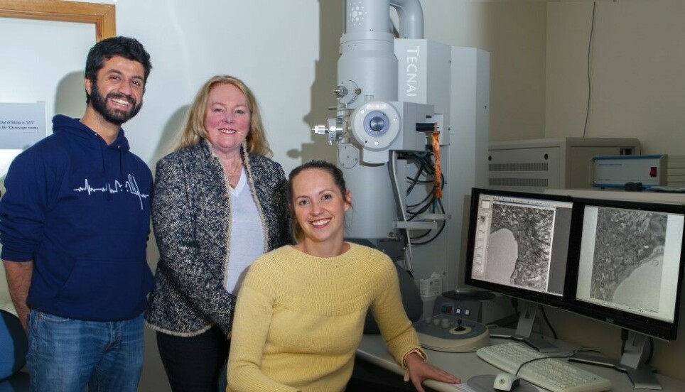 Earlier research has shown that several of the same risk factors behind the development of cardiovascular disease also can lead to Alzheimer’s. Pictured left to right: Shreyas B. Rao, Reidun Torp and Gry H.E. Syverstad Skaaraas.