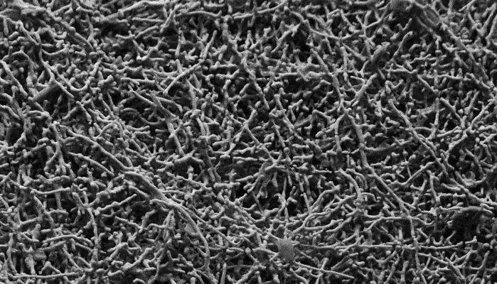 Nanowires made out of a lithium-oxide garnet ceramic filler known as LLZO as seen under a scanning electron microscope.