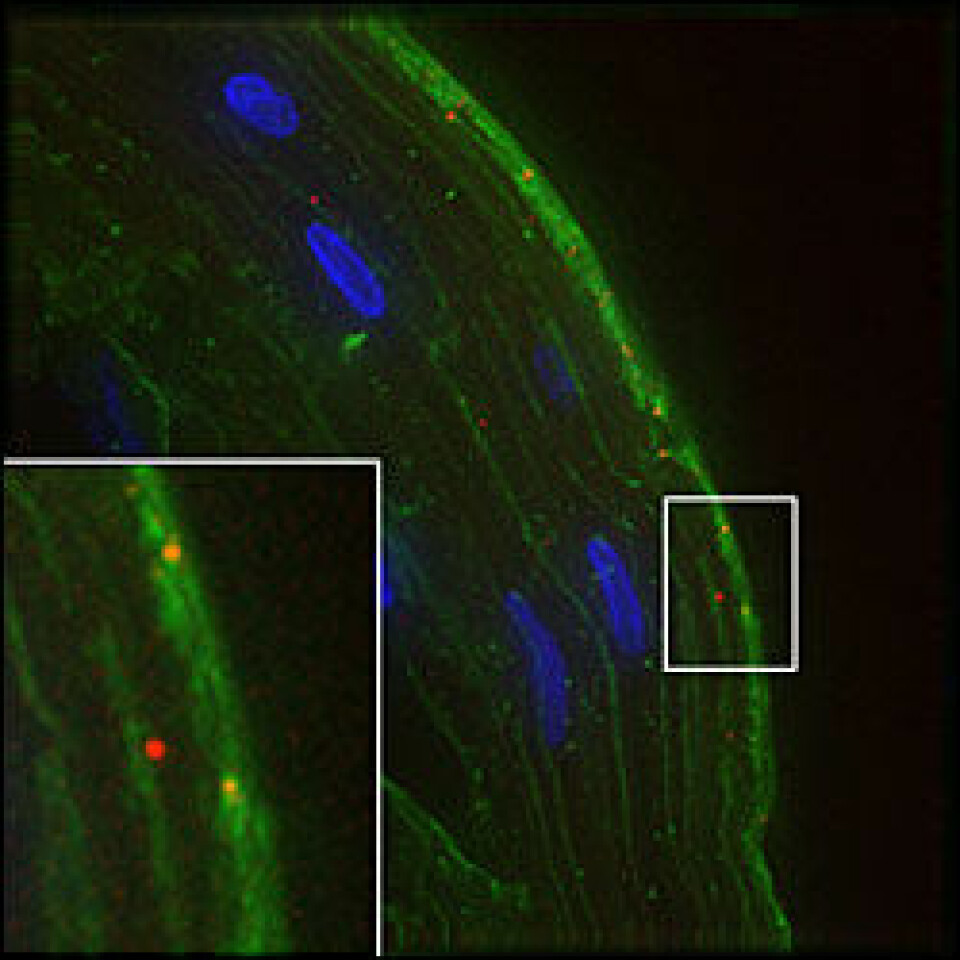 'Dette mikroskopiske bildet viser HIV (rød prikk) som kommer gjennom det vaginale vevet. (Foto: Hope laboratory)'