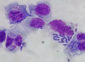 Natural Killer celler fra storfe infisert med tachyzoitter fra Neospora caninum. (Foto: Anne Storset)