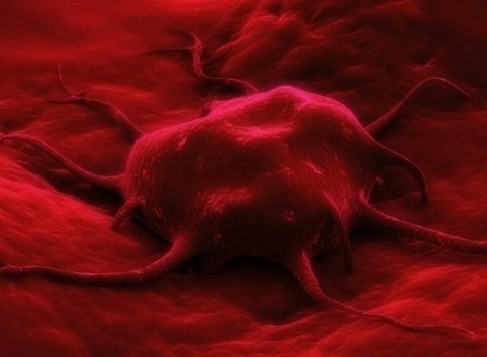 Kreftcelle (Foto: Istockphoto)