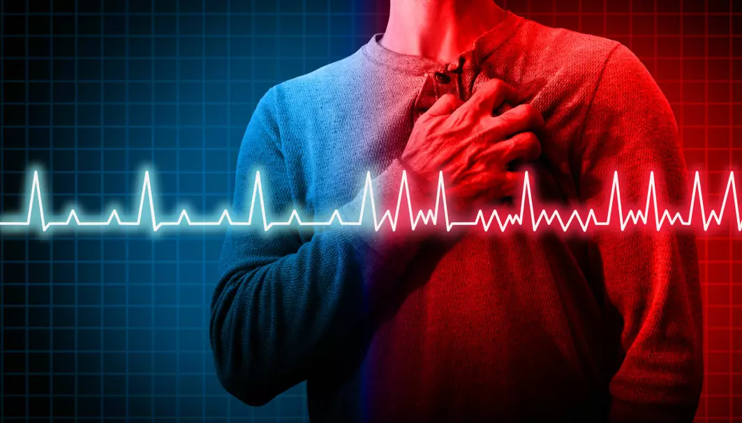 Slik kan hjerterytmen se ut hos en person med hjerteflimmer. Normal hjerterytme til venstre.
