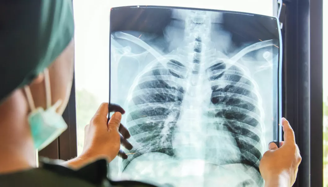 Lungekreftpasienter har dårlige prognoser. Men teknologien bak de nye covid-vaksinene kan gi oss mer treffsikker og mindre skadelig behandling av lungekreft.