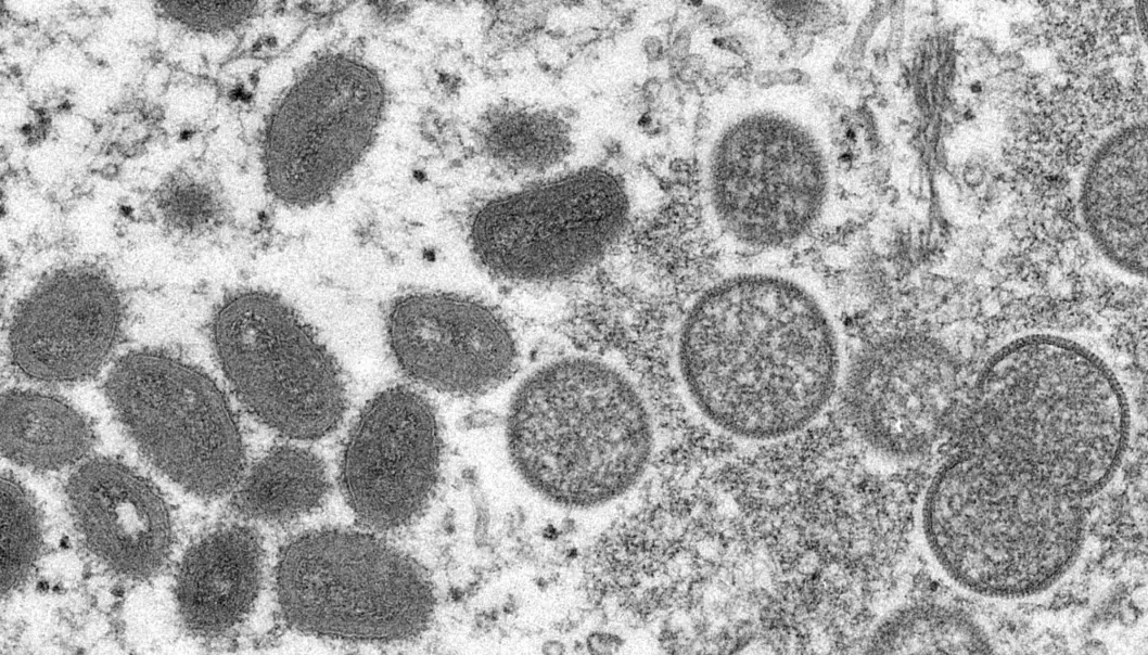 Dette mikroskop-bildet viser forskjellige typer apekopp-virus.