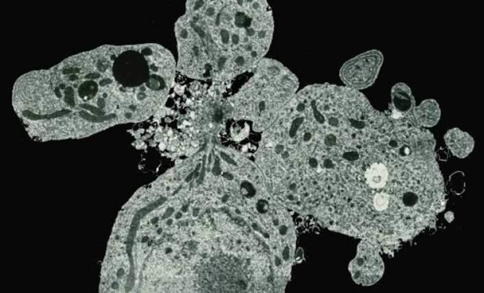 Dette elektronmikroskopiske bildet viser en celle som tar selvmord (apoptose). Cellens innhold pakkes inn i membranvesikler og snøres av fra cellen. Disse apoptotiske vesiklene ville i kroppen vår blitt "spist" av andre celler. Foto: Kari E. Fladmark