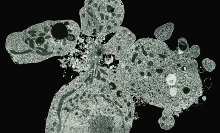 Dette elektronmikroskopiske bildet viser en celle som tar selvmord (apoptose). Cellens innhold pakkes inn i membranvesikler og snøres av fra cellen. Disse apoptotiske vesiklene ville i kroppen vår blitt "spist" av andre celler. Foto: Kari E. Fladmark Dette elektronmikroskopiske bildet viser en celle som tar selvmord (apoptose). Cellens innhold pakkes inn i membranvesikler og snøres av fra cellen. Disse apoptotiske vesiklene ville i kroppen vår blitt "spist" av andre celler. Foto: Kari E. Fladmark