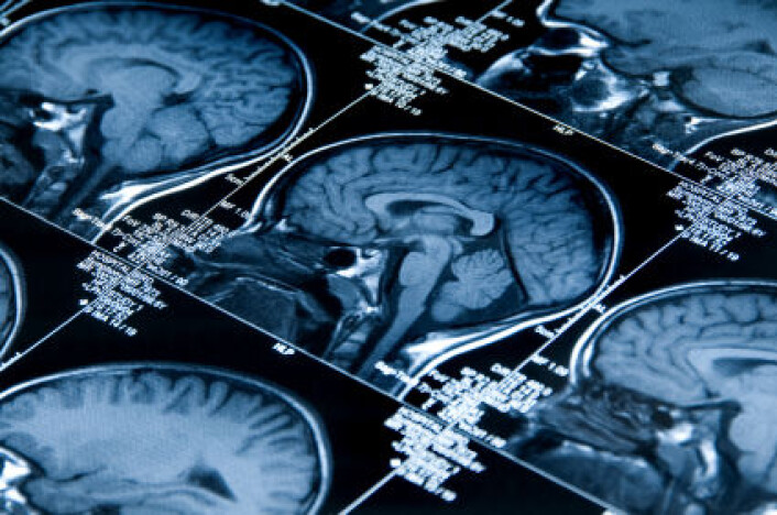 MRI av en hjerne. Hvor plastisk er den etter at den har blitt voksen?(Illustrasjonsfoto: iStockphoto) MRI av en hjerne. Hvor plastisk er den etter at den har blitt voksen?(Illustrasjonsfoto: iStockphoto)