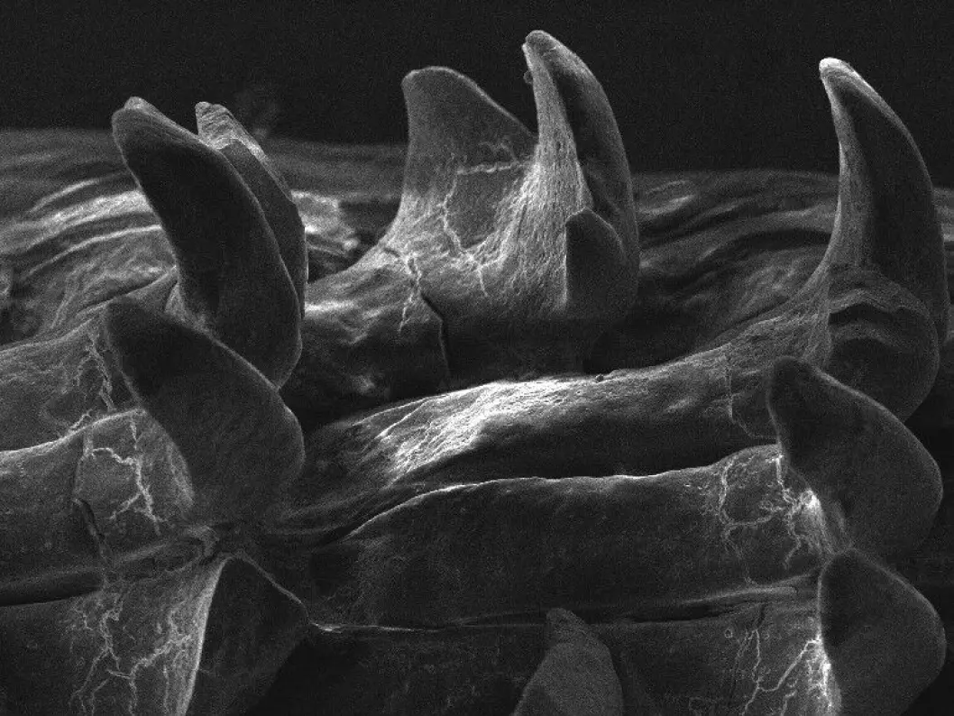 Et elektronmikroskopbilde fra en liten del av raspetungen til albuesneglen.