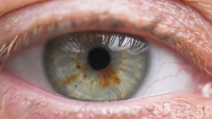 Regnbuehinnen, eller iris, er den fargede delen av øyet hos virveldyr, inkludert mennesker. (Foto: YAY micro) Regnbuehinnen, eller iris, er den fargede delen av øyet hos virveldyr, inkludert mennesker. (Foto: YAY micro)