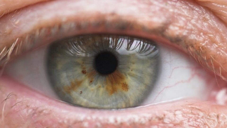 Regnbuehinnen, eller iris, er den fargede delen av øyet hos virveldyr, inkludert mennesker. (Foto: YAY micro)
