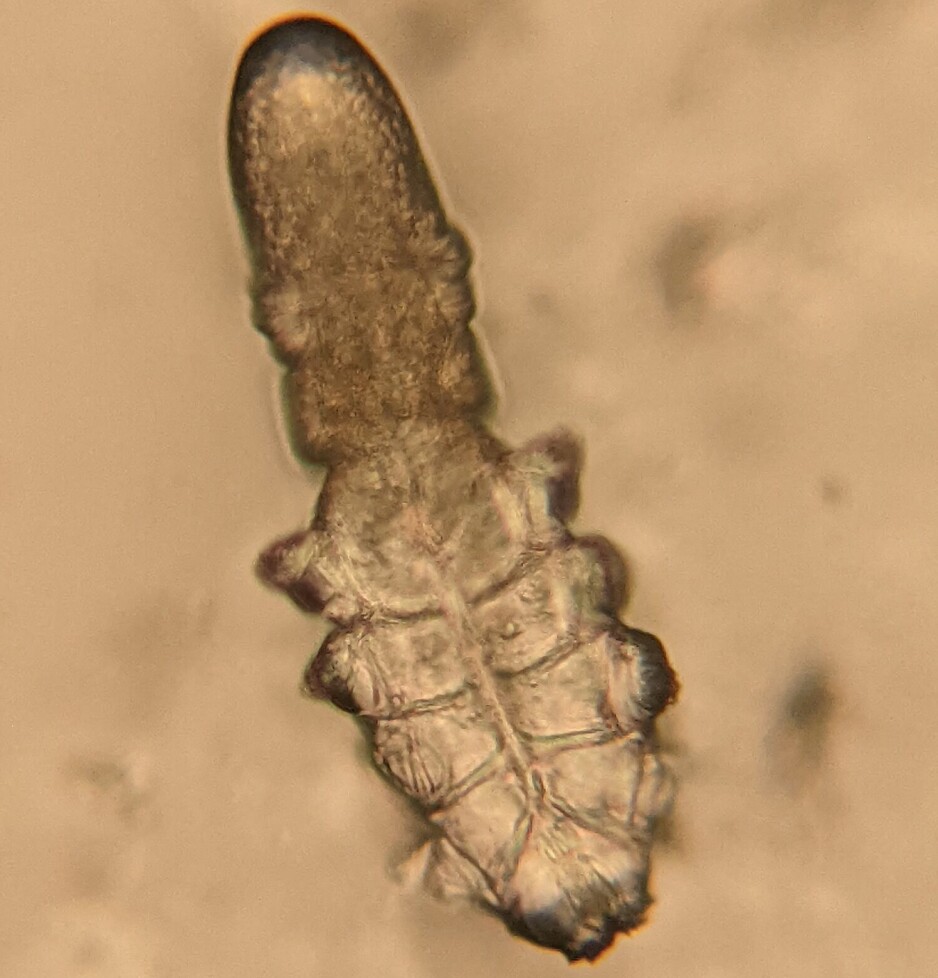 Et annet mikroskop-bilde av Demodex-midden. Her ser du tydelig de korte beina.