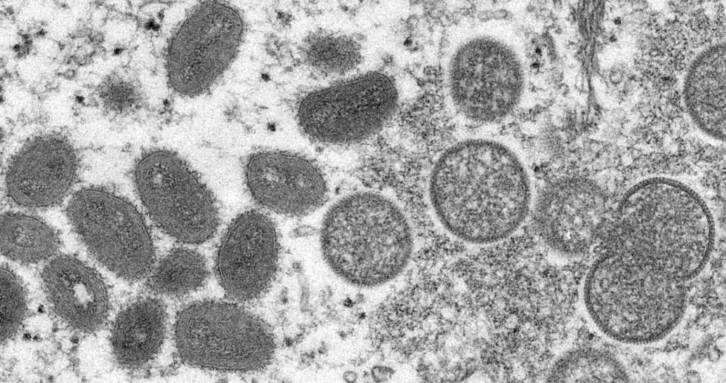 Apekoppviruset har utviklet seg overraskende raskt, viser studie.