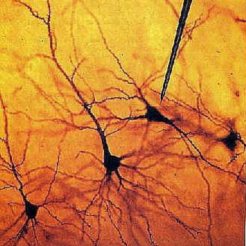 En elektrode måler aktivitet fra et nevron (hjernecelle). (Foto: UMB)