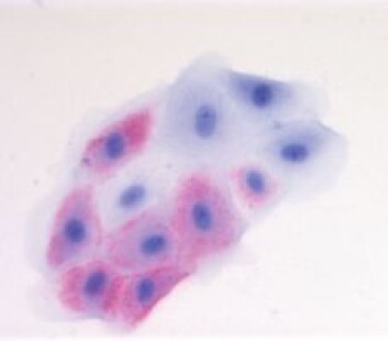 Gjelle-epitelceller i kultur infisert med ferskvatnsisolat av VHS-virus (raud farge). Gjelle-epitelceller i kultur infisert med ferskvatnsisolat av VHS-virus (raud farge).